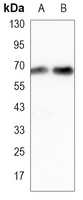 ALB Mouse Monoclonal Antibody