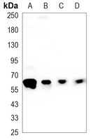 AKT Mouse Monoclonal Antibody