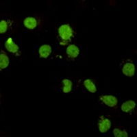 CHD3 Mouse Monoclonal Antibody