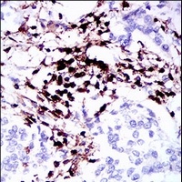 CD45 Mouse Monoclonal Antibody