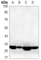 PSMB8 Mouse Monoclonal Antibody