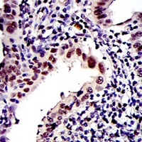 PSMB8 Mouse Monoclonal Antibody
