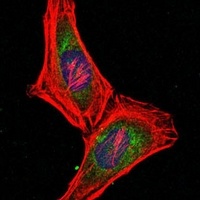 PSMB8 Mouse Monoclonal Antibody