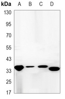 Synaptophysin Mouse Monoclonal Antibody