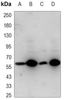 Metadherin Mouse Monoclonal Antibody