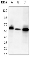 PAK2 Mouse Monoclonal Antibody