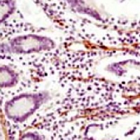 LPP Mouse Monoclonal Antibody