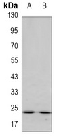 GSTP1 Mouse Monoclonal Antibody