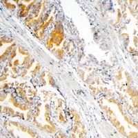 GSTP1 Mouse Monoclonal Antibody