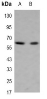 GAD2 Mouse Monoclonal Antibody