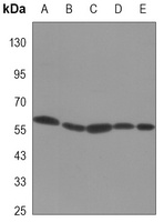 Vimentin Mouse Monoclonal Antibody
