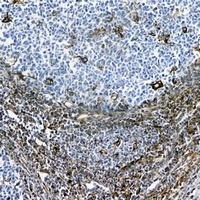 Vimentin Mouse Monoclonal Antibody