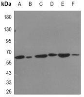HSP60 Mouse Monoclonal Antibody