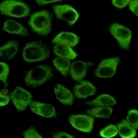 HSP90 beta Mouse Monoclonal Antibody