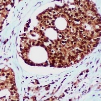 RAD23B Mouse Monoclonal Antibody