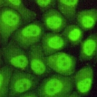 RAD23B Mouse Monoclonal Antibody