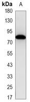 MMP2 Mouse Monoclonal Antibody