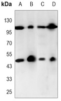 NF-kappaB p105 Mouse Monoclonal Antibody