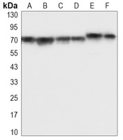 IGF2BP3 Mouse Monoclonal Antibody