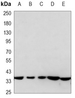 AMPK beta 1 Mouse Monoclonal Antibody