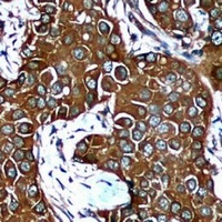 AMPK beta 1 Mouse Monoclonal Antibody