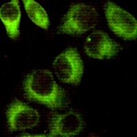 AMPK beta 1 Mouse Monoclonal Antibody