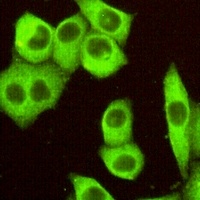DR5 Mouse Monoclonal Antibody