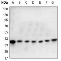 p38 Mouse Monoclonal Antibody