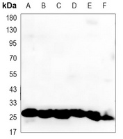 HSP27 Mouse Monoclonal Antibody