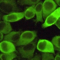 HSP27 Mouse Monoclonal Antibody