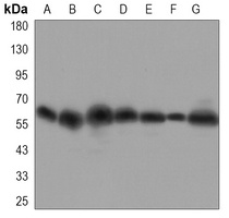 FYN Mouse Monoclonal Antibody