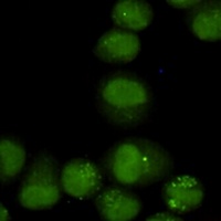 GTF2H1 Mouse Monoclonal Antibody