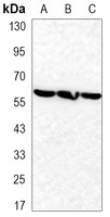 TBL1XR1 Mouse Monoclonal Antibody