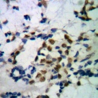 TBL1XR1 Mouse Monoclonal Antibody