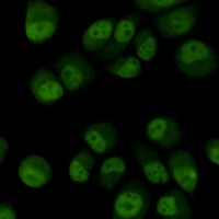 TBL1XR1 Mouse Monoclonal Antibody