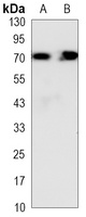 HSP70 Mouse Monoclonal Antibody