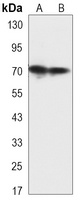 HSP70 Mouse Monoclonal Antibody