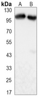 TIF1 beta Mouse Monoclonal Antibody