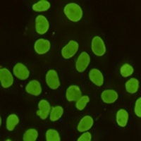 TIF1 beta Mouse Monoclonal Antibody