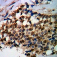 PPX Mouse Monoclonal Antibody