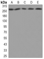 FASN Mouse Monoclonal Antibody