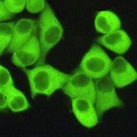 FASN Mouse Monoclonal Antibody