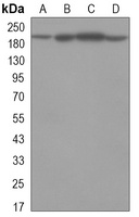 KDM5C Mouse Monoclonal Antibody