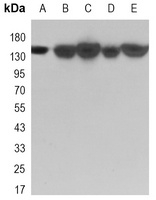 KDM4A Rabbit Monoclonal Antibody