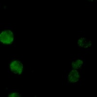 PKC beta Rabbit Monoclonal Antibody