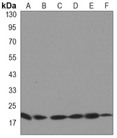 UBC9 Rabbit Monoclonal Antibody