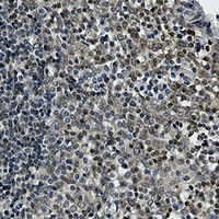 UBC9 Rabbit Monoclonal Antibody