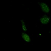 UBC9 Rabbit Monoclonal Antibody