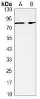 RSK2 Rabbit Monoclonal Antibody