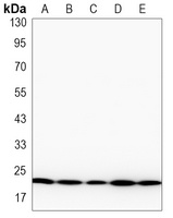 NRAS Rabbit Monoclonal Antibody